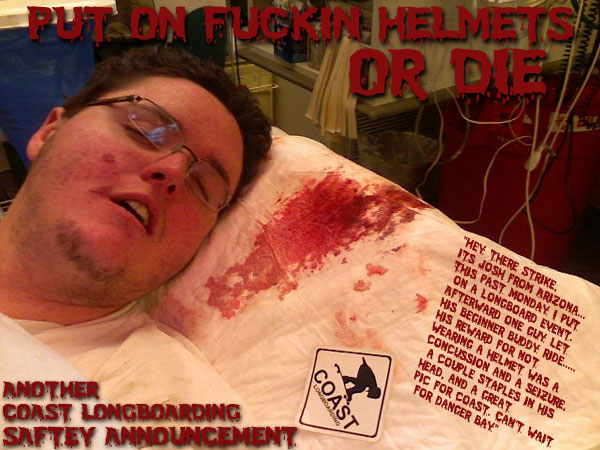 WATCH THIS VIDEO  'WIPE OUT' YOU THINK THAT HELMETS SUCK!!!! CLICK HERE ...CHECK THIS VIDEO!!!! AND PUT ON YER HELMETS OR FUCKIN DIE!!!!!!! 'CRASH AND LEARN'. Josh from Arizona SENT THIS IN!!! NICE TOUCH ON THE STICKER MAN!!!! HAVE A GOOD WEEKEND YOU ALL!! RIDE SAFE ..COAST!!
				
 on COASTLONGBOARDING.COM